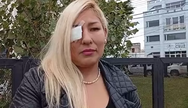 Una inspectora de tránsito resultó herida tras la caída de una puerta en su lugar de trabajo
