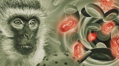 Mpox en Argentina: cómo identificar los primeros signos de la viruela del mono