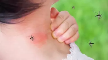 Mosquitos Rojos en Mendoza: La Innovadora Técnica del Insecto Estéril Contra el Dengue